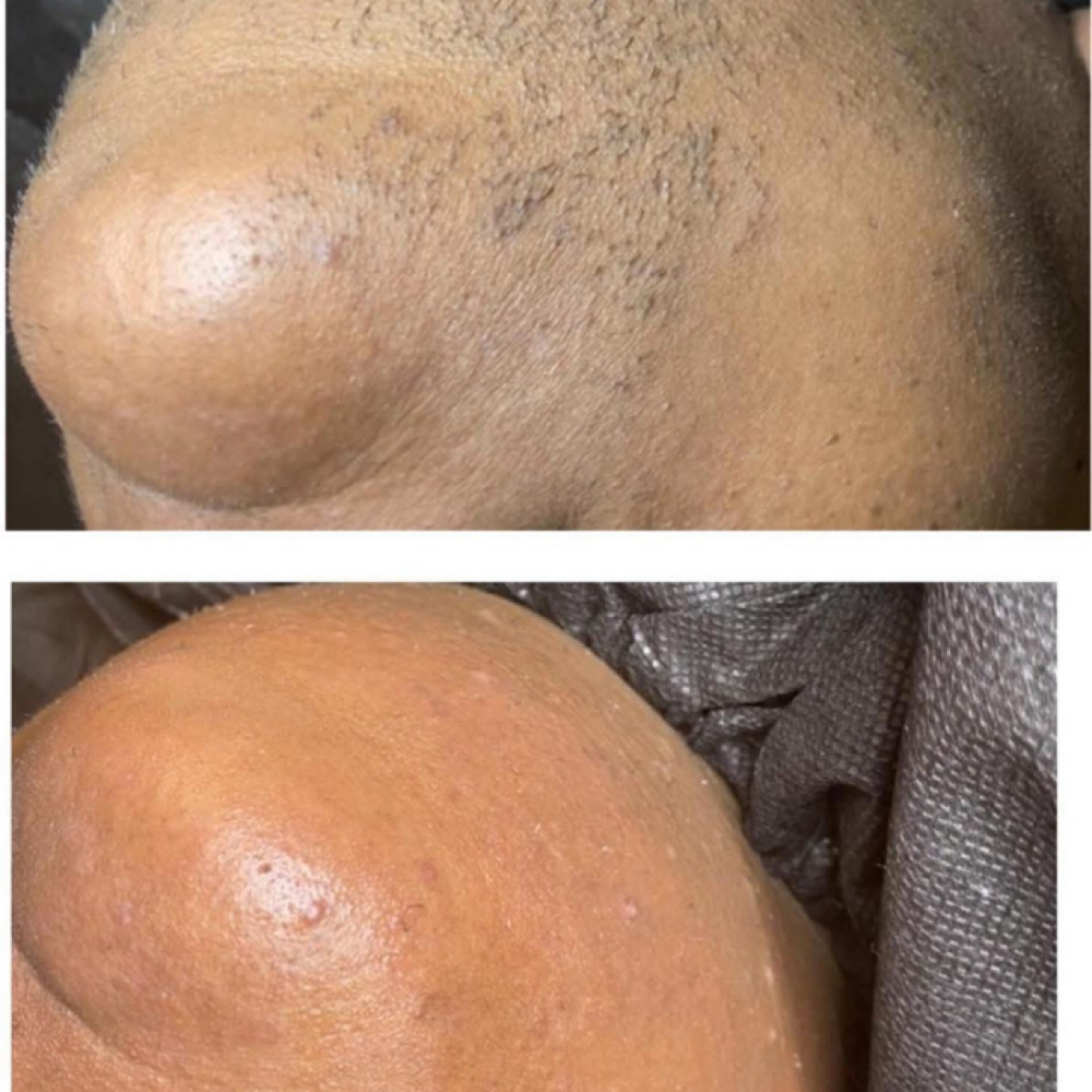 Chin Wax at Asia’s Oasis in Syracuse NY, NY