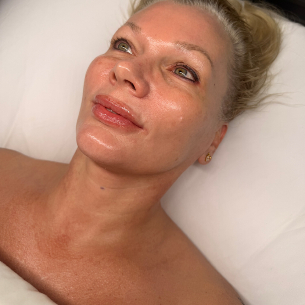 75-Minute Luxury Corrective Facial at Green Haus Aesthetics in Brentwood, TN