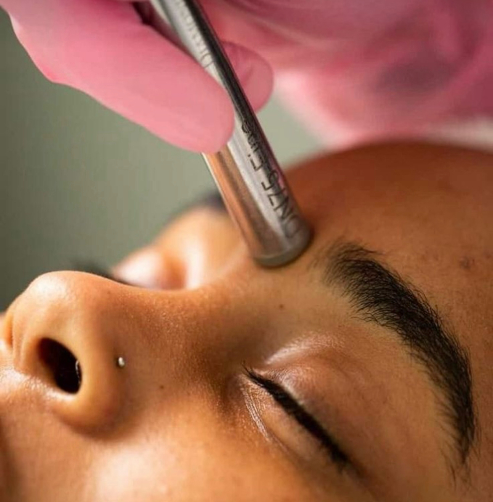 Microdermbrasion Facial