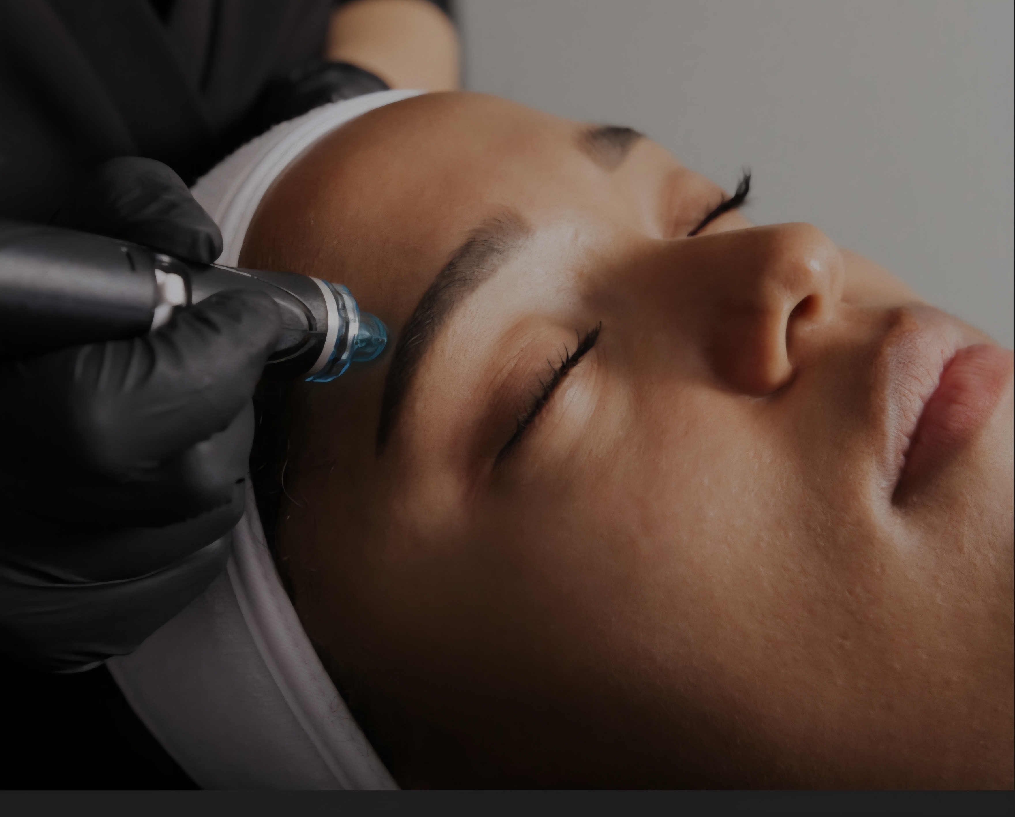 Microneedling at CC Glow Bar in Pearland, TX