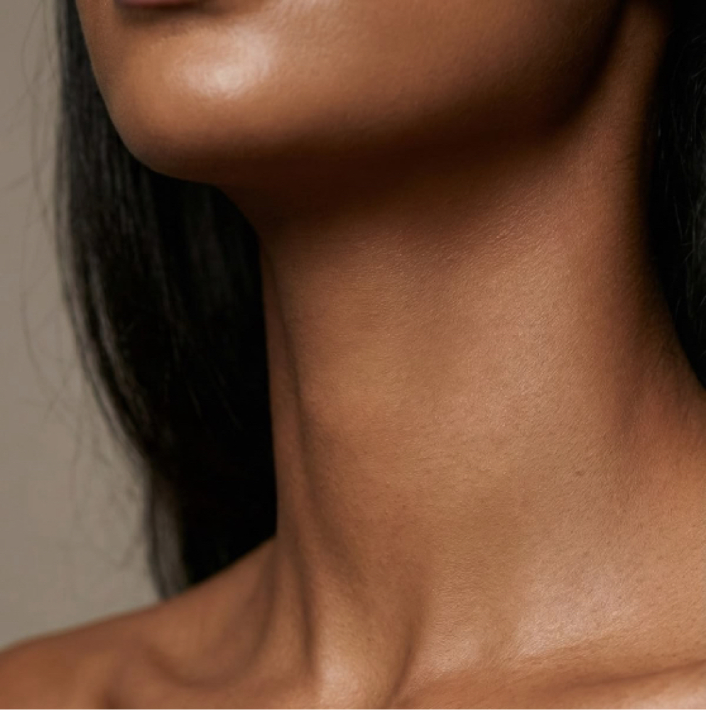 Microneedling (Face + Neck) at Bare Beauty Wax & Skin in Loveland, CO
