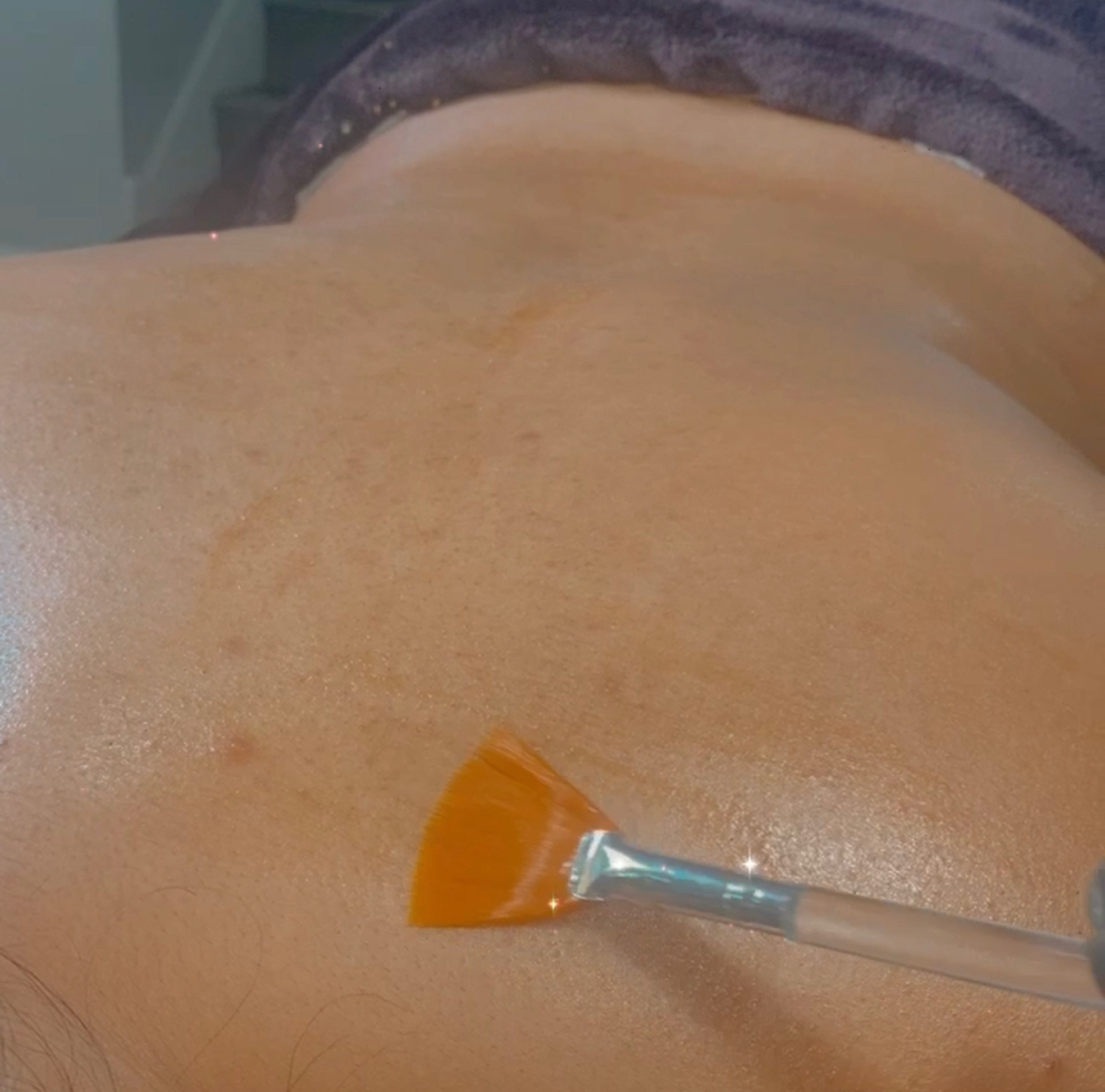 Custom Bacial (Back Facial)