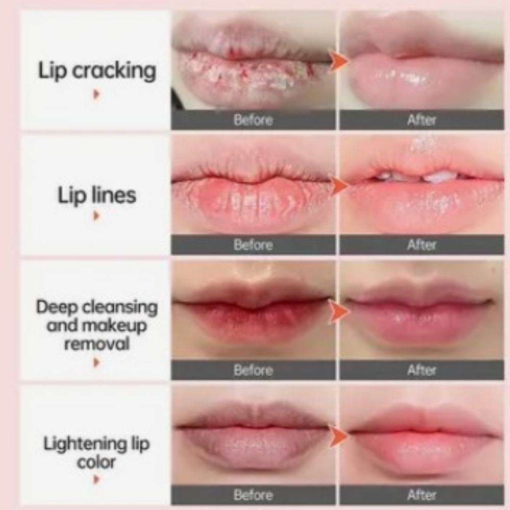 Hydrajelly Lips With Color Pigment at Boujee Asthetics ✨ in Tucson, AZ