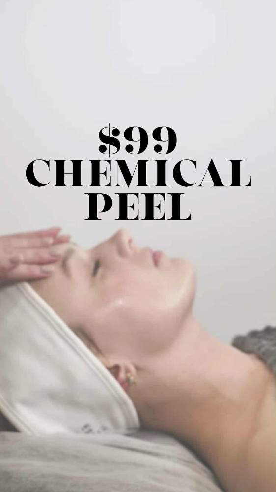 Chemical Peel
