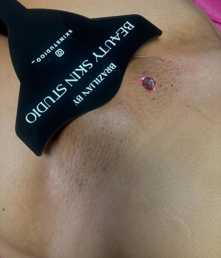 Yoni Glow Lock-In (14 Sessions)