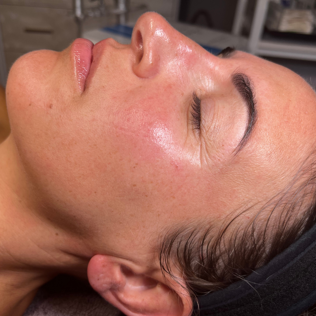 Customized Signature Facial