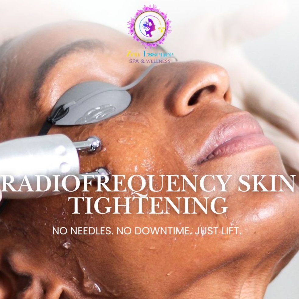 Radio Frequency Skin Tightening at Zen Essence Spa & Wellness in Brooklyn, NY