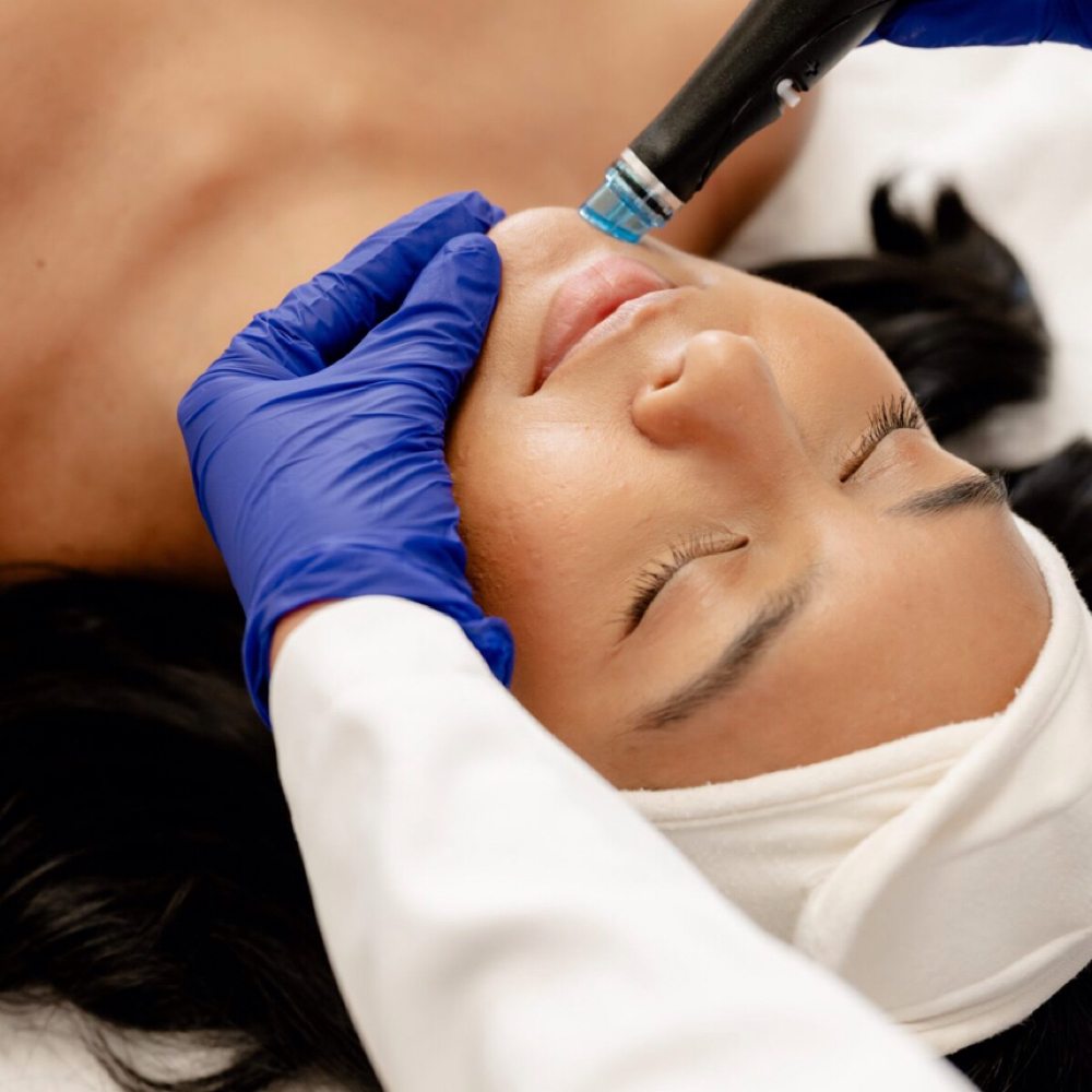 Hydrafacials MD at NEYTIV in NY 11935, NY