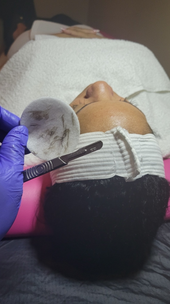 Dermaplaning facial