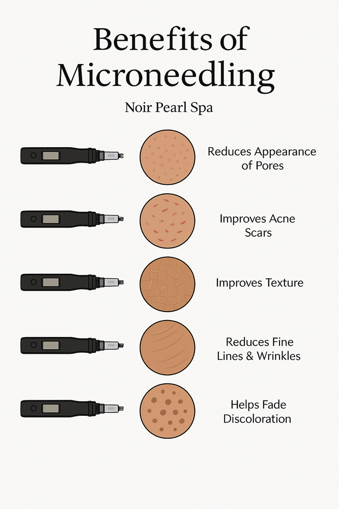 Microneedling