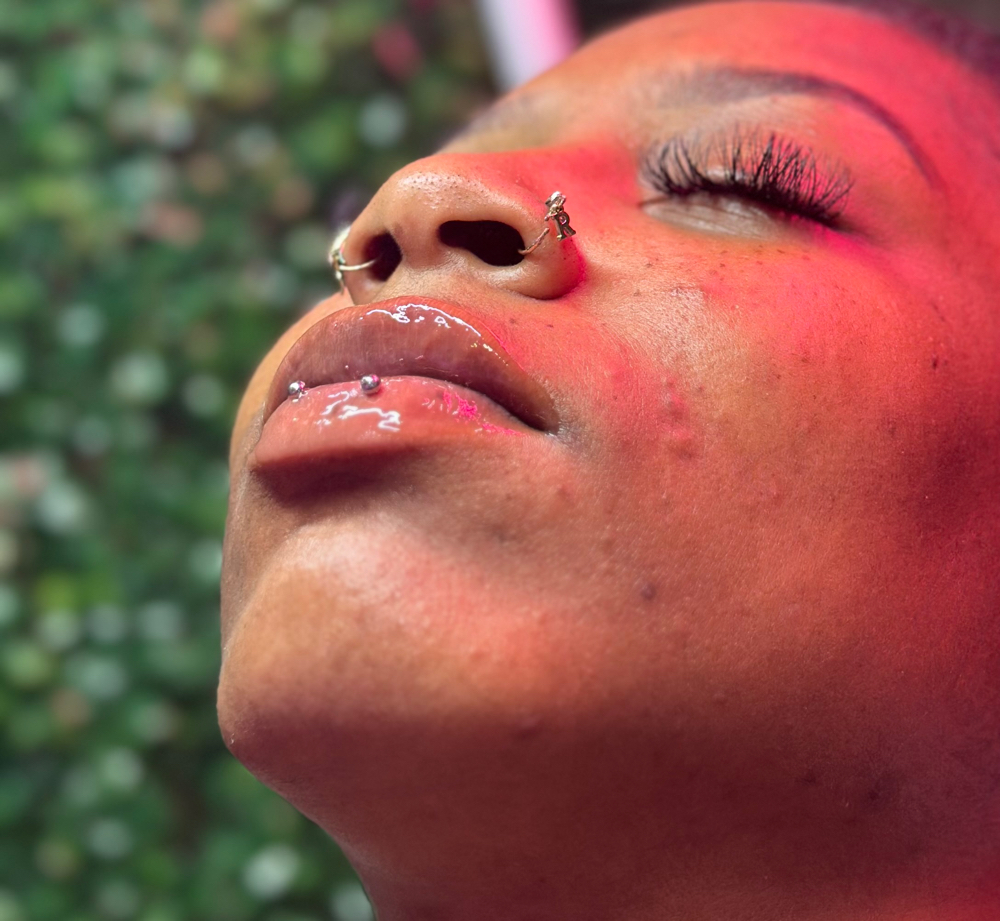 Lip Filler 0.5 ML👄