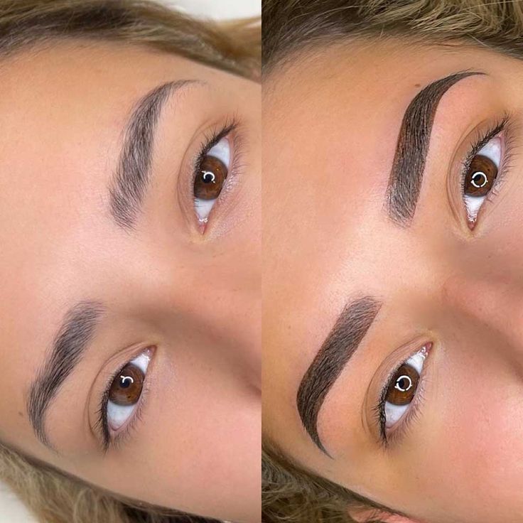 Microshading