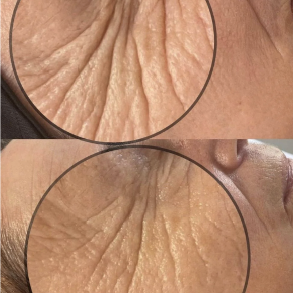 Tighten and Lift Protocol at Skin & Soul in Brooklyn, NY