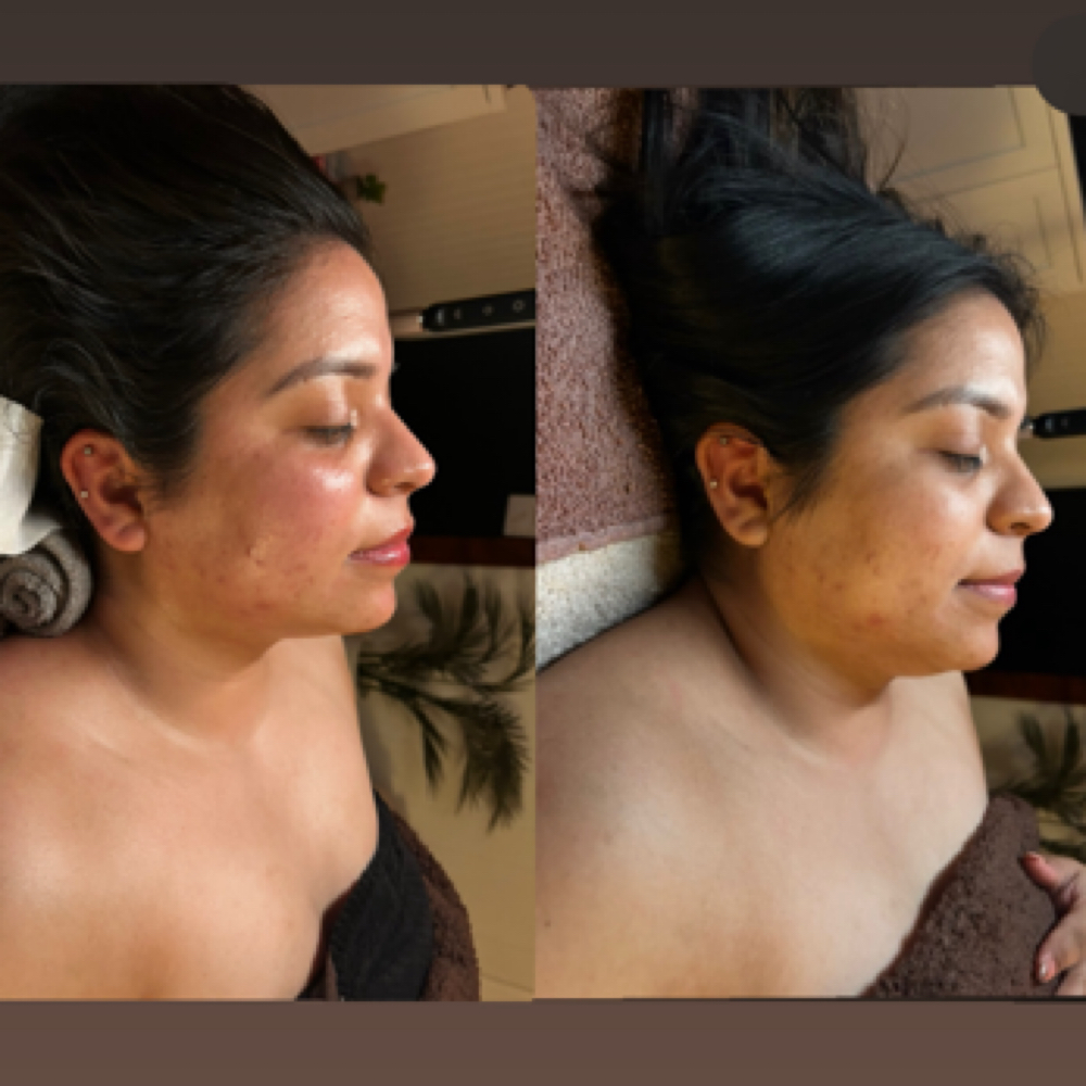 Sculpted Skintherapy Facial at Maddie’s Skin Therapy in Fort Payne, AL