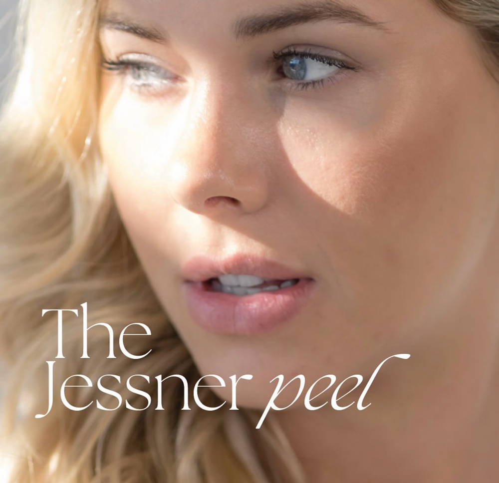 Mid Level Chemical Peel (Jessner)