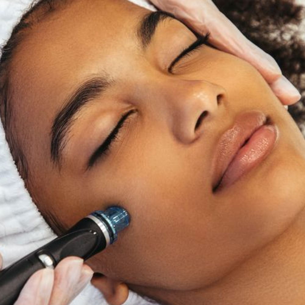 Microneedling With PRP/ Face at Trilogy Aesthetics Medspa & Wellness in Atlanta, GA
