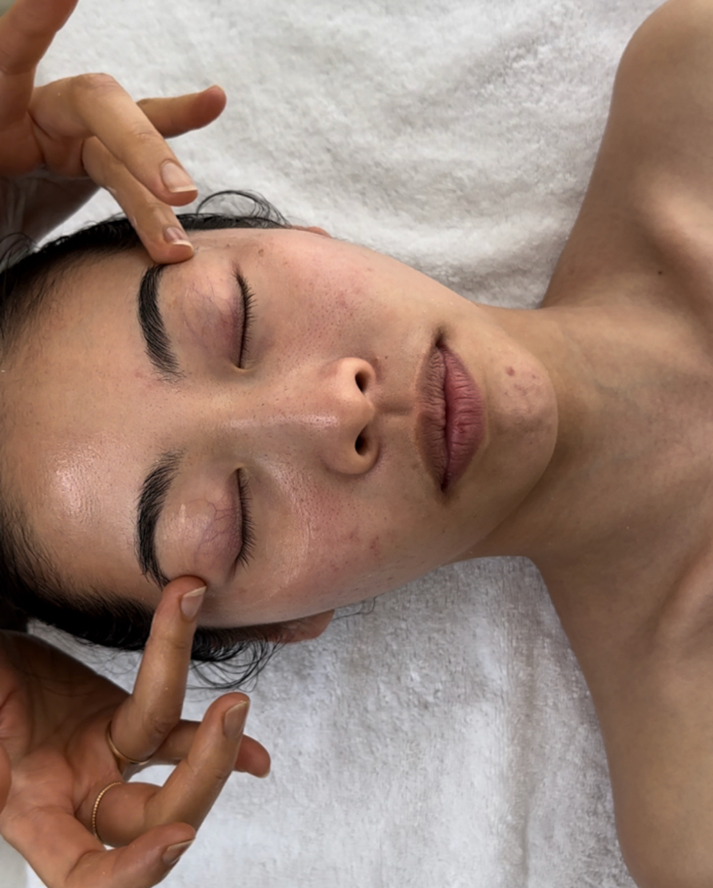 Skin Consultation