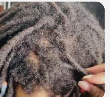 Extended Svc Fee- Retwist/Interlock