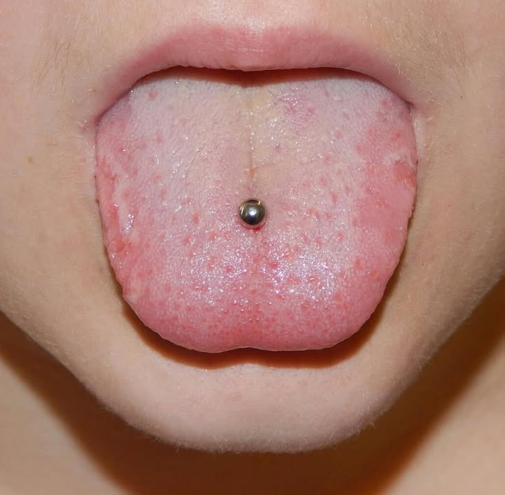 Oral Piercing