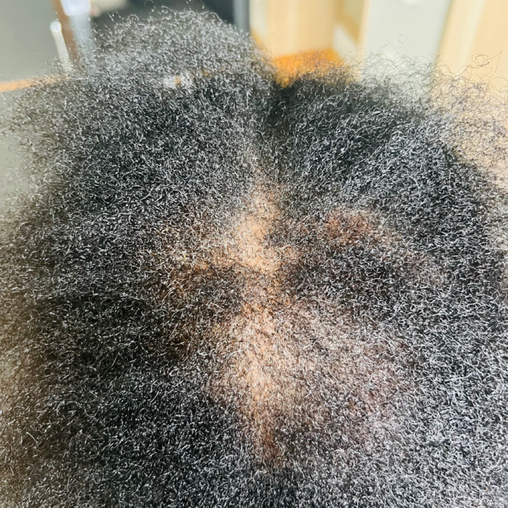 Hair loss services at Bandoo salon & spa in San Antonio, TX