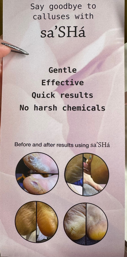 Add On To Pedicure For Rough Callus at Tips and toes nail spa in Converse, TX