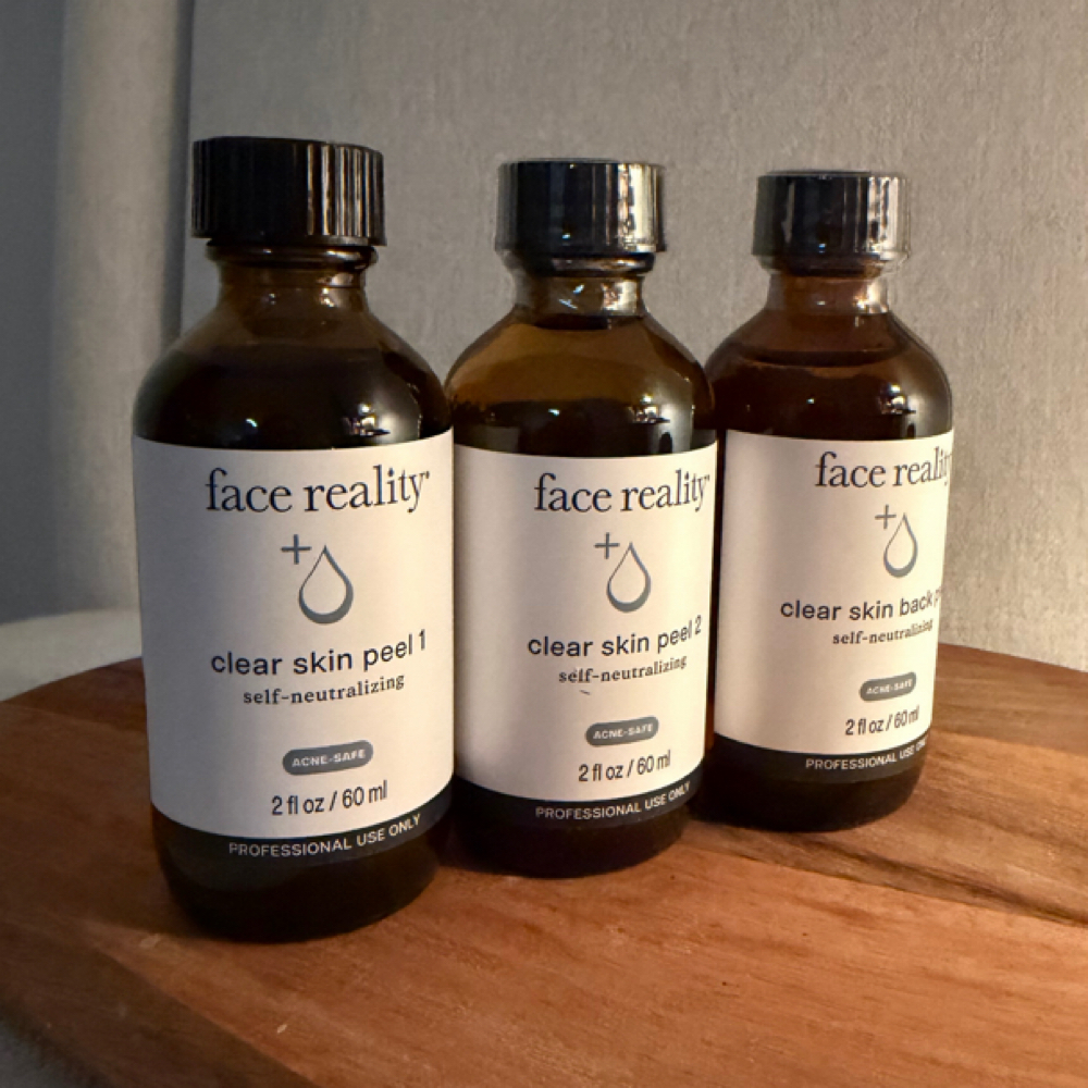 Acne Treatment (Bootcamp Clients) at True Skin Aesthetics in Crestview Hills, KY