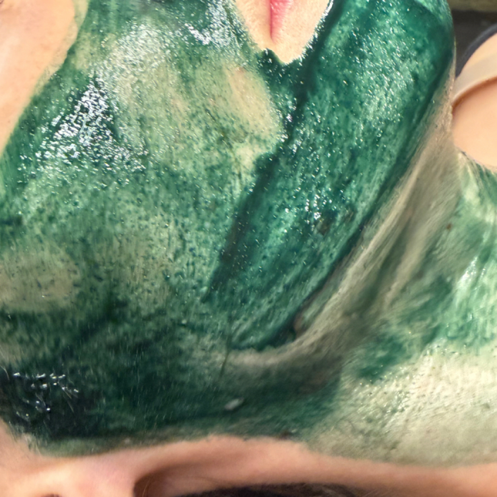 GREEN SEA PEEL-liquid microneedling at Magic Mirror Aesthetics in Portland, OR