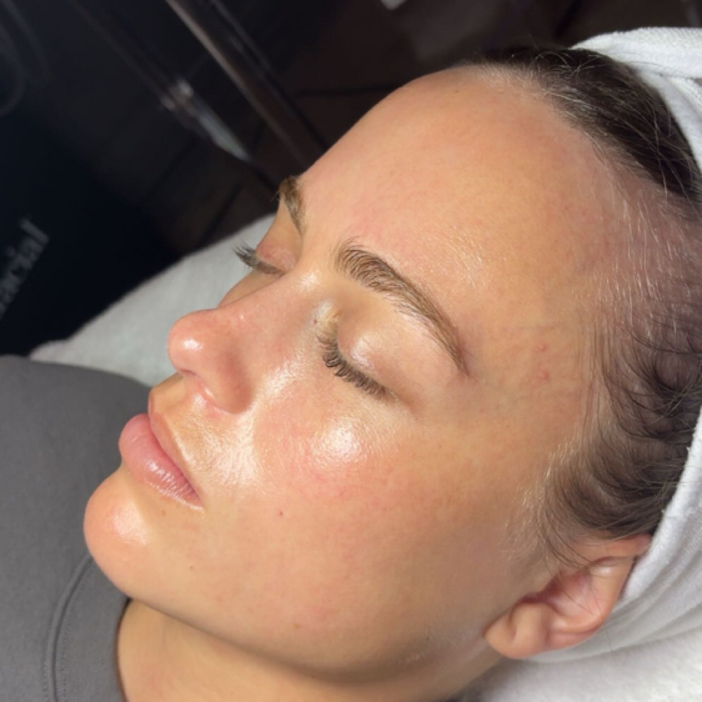 Dermaplane at Lindsay Aesthetics in Pontotoc, MS