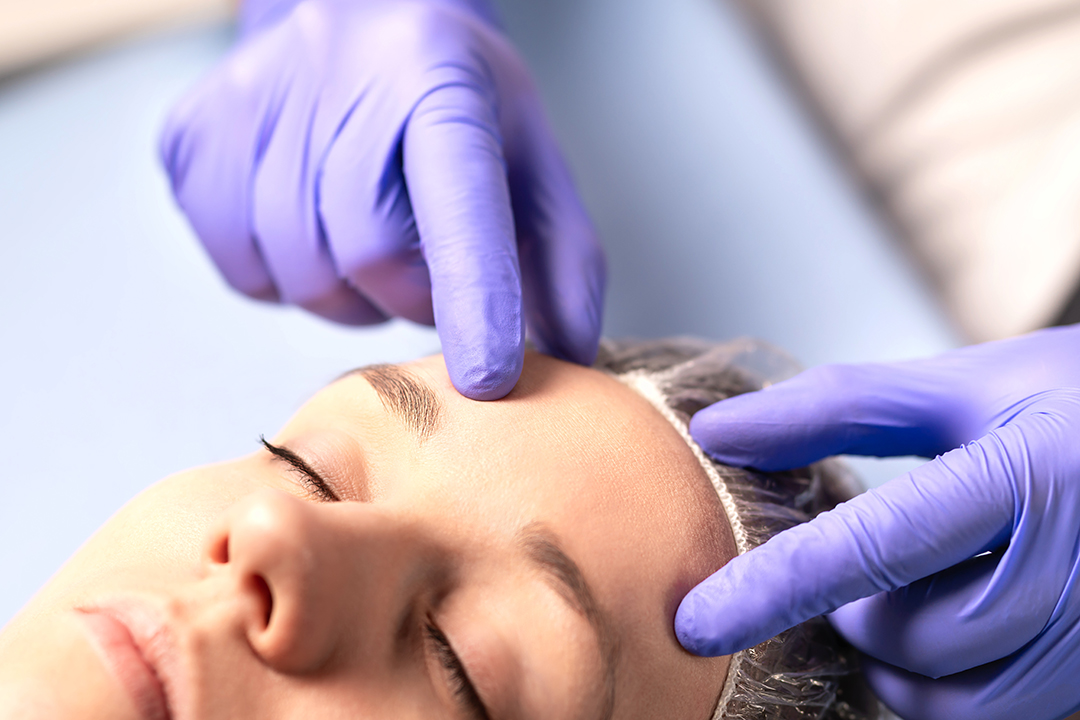 Skin Consultation