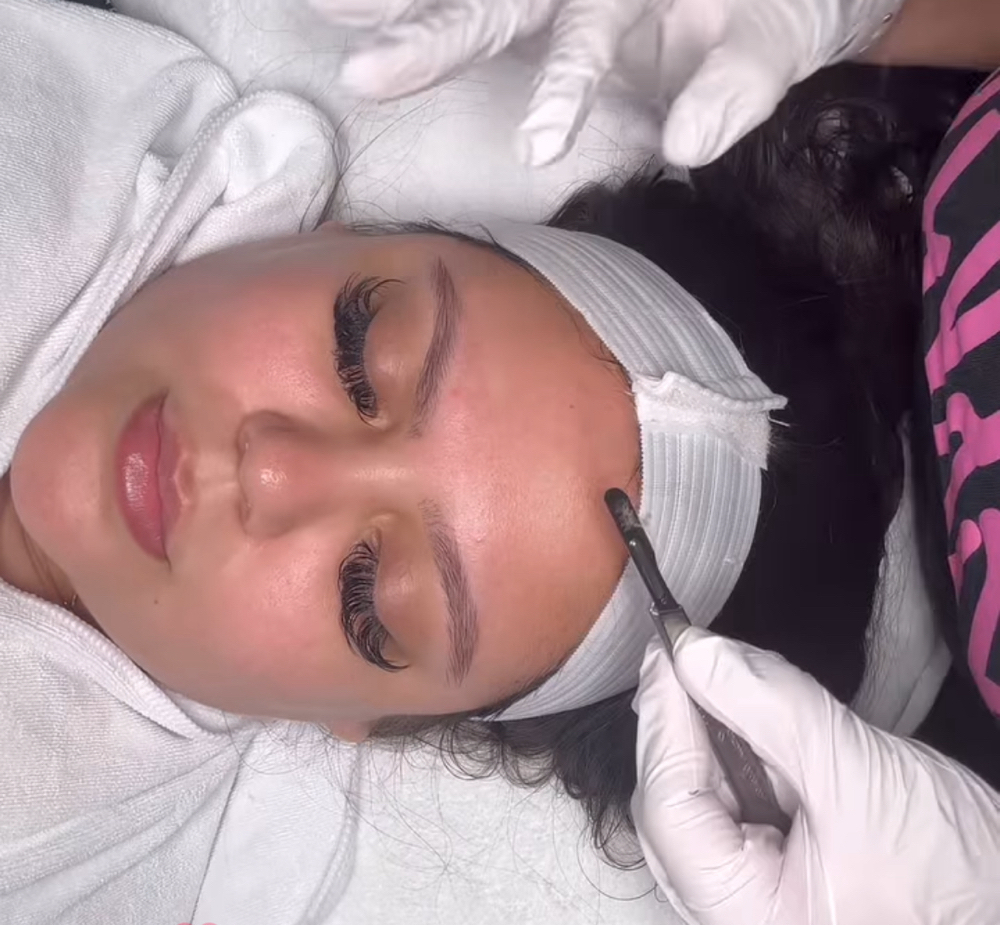 DermaPlaning, Add-On