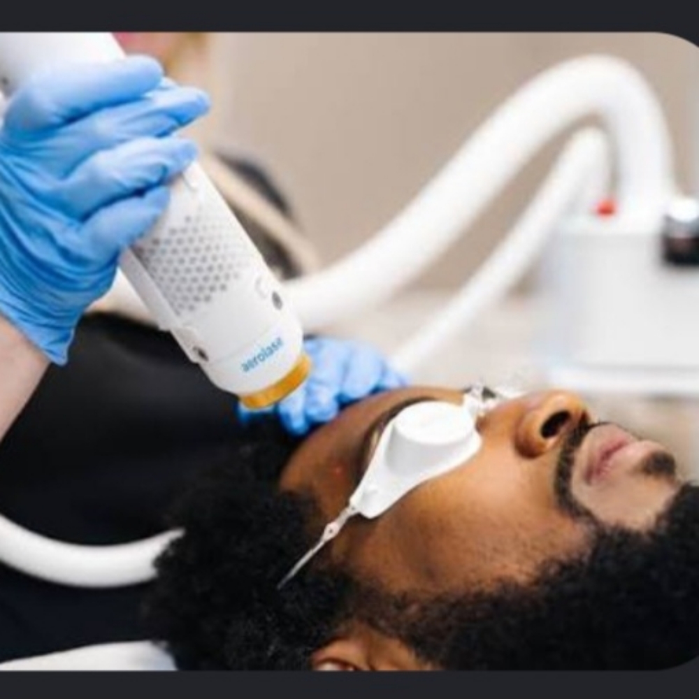 Aerolase Laser Treatment at BeautyGlo Aesthetics in San Antonio, TX