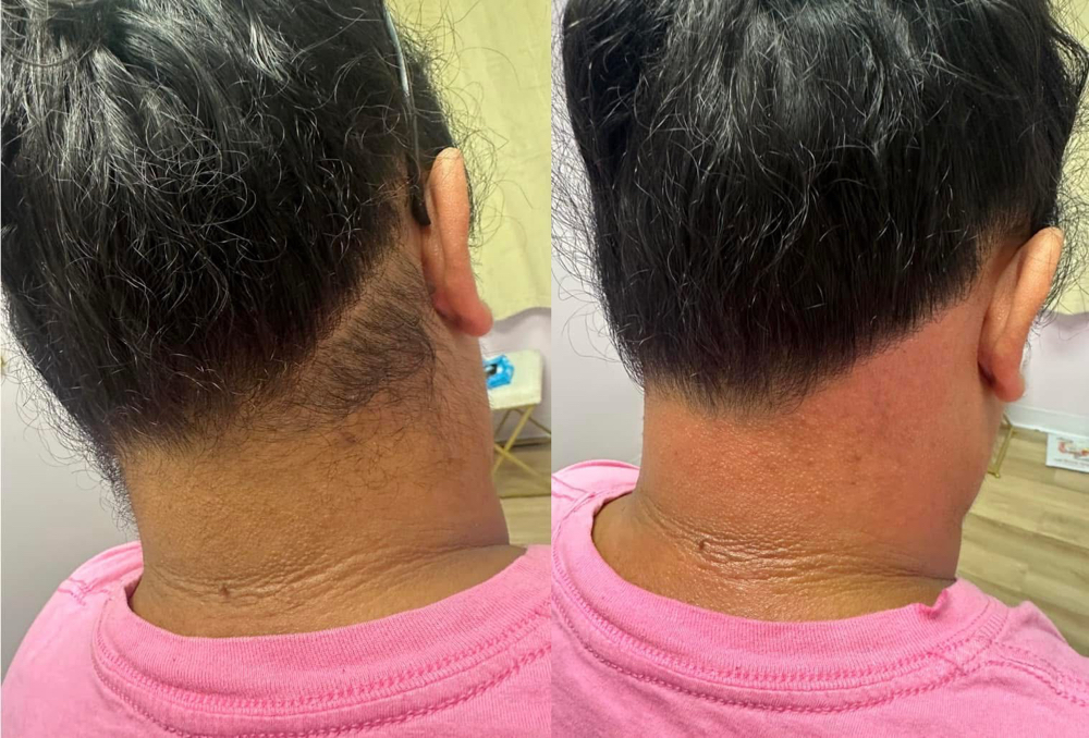 Hairline Wax