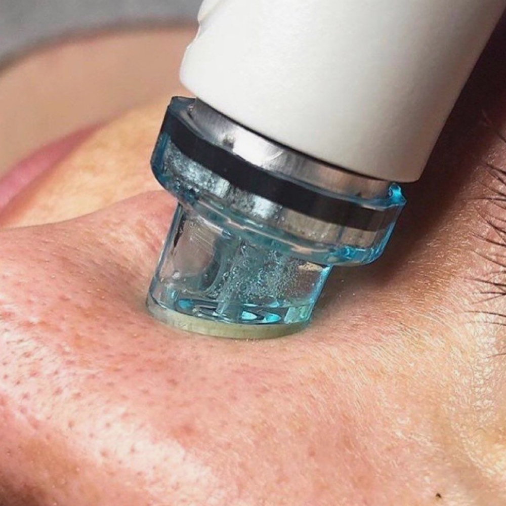 Hydro Facial at The Shelton Studio in Shelbyville, TN
