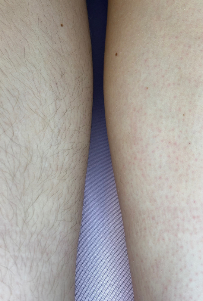 Half Leg at One Stop Beauty Shop in Cranston, RI