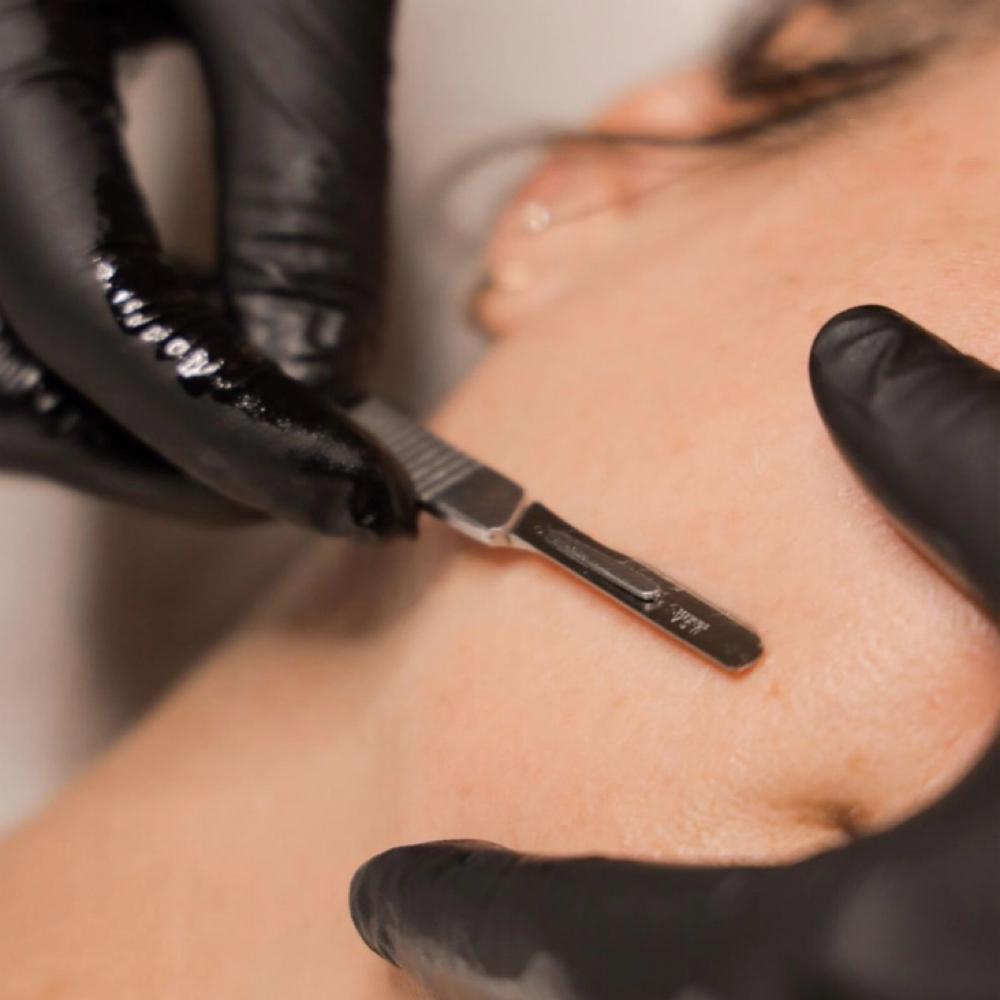 refresh dermaplane at re:set in Dallas, TX