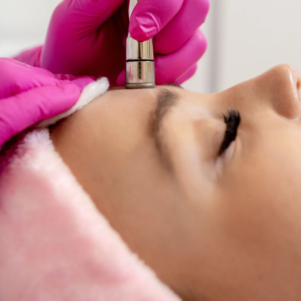 Microdermabrasion Facial