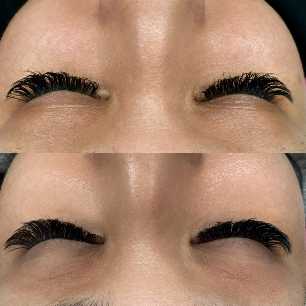 Mini Fill (within 1 Week)