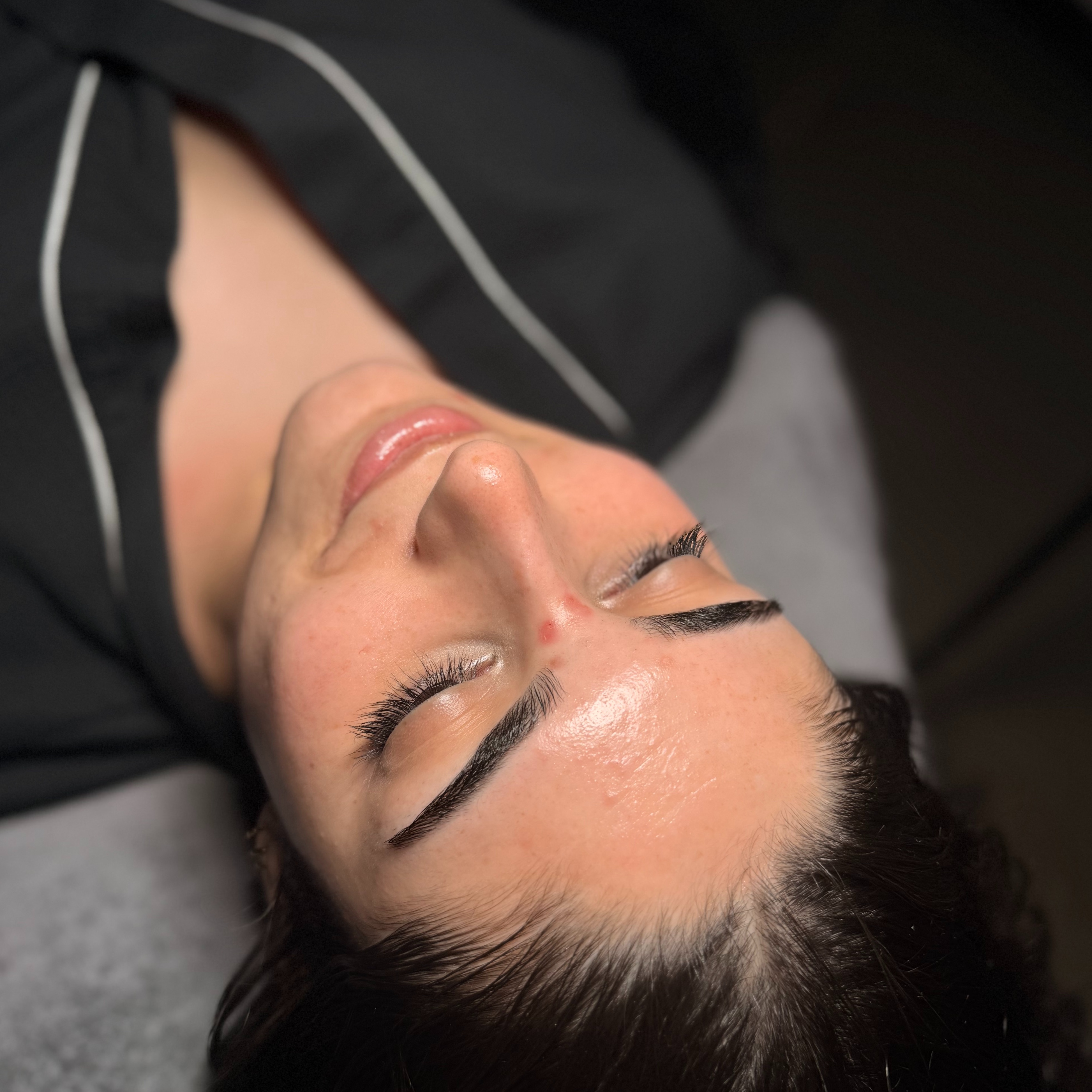 Hydra C Facial at SKINSPOT ADVANCED AESTHETICS in TAUNTON, MA