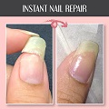 Nail Repair