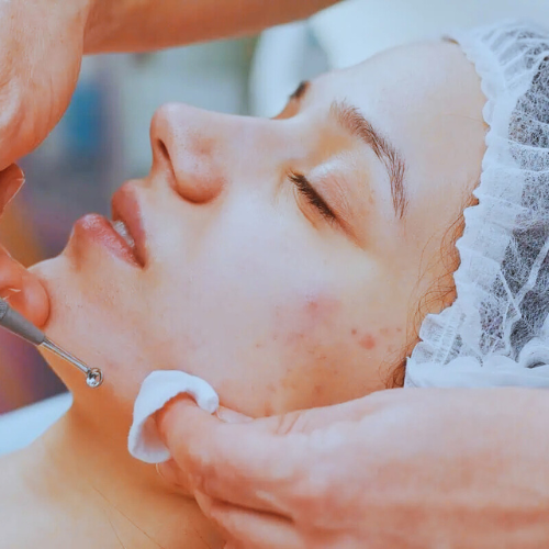 Skin Clearing Facial