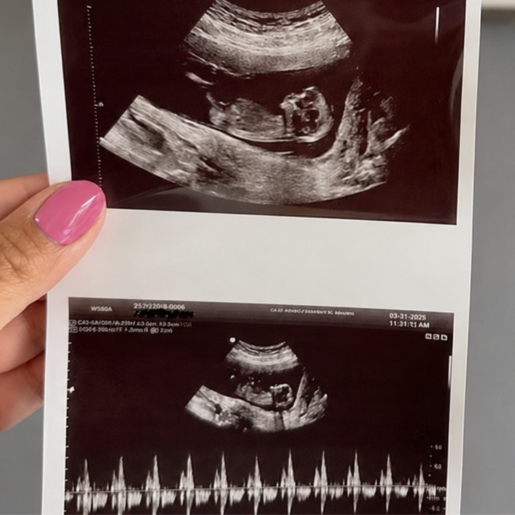 Weekday Baby Peek at Whittier 3D 4D Ultrasound by 4D Special Delivery in Whittier, CA