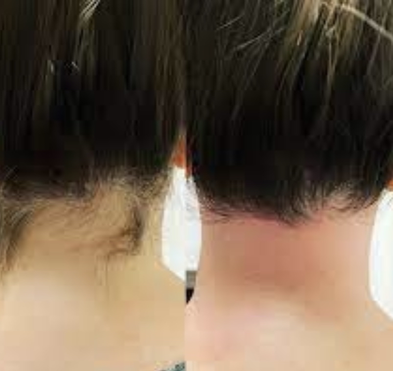 Neck Wax Women