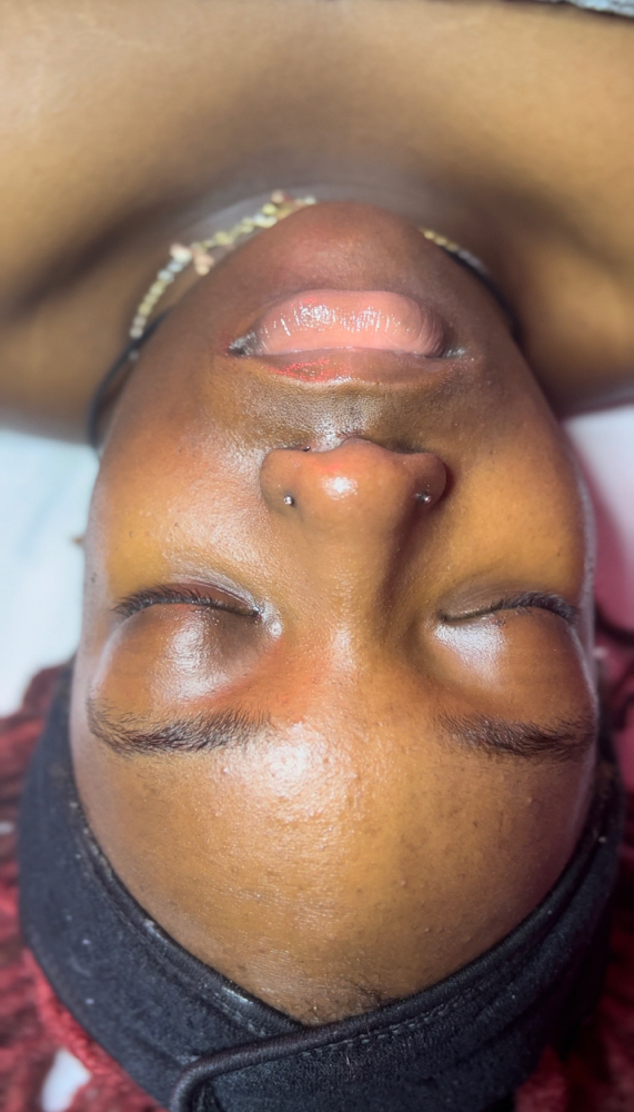 Teen Facial
