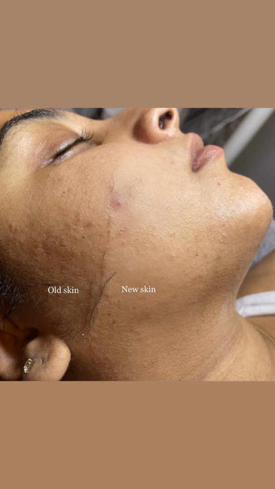 Get Up & Glow (Dermaplaning Facial)