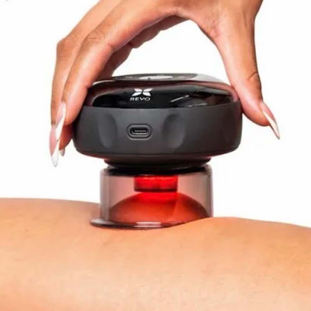 Anti-Cellulite Cupping Therapy at BLAZEBODYSPA & BEAUTY BAR in TINLEY PARK, IL