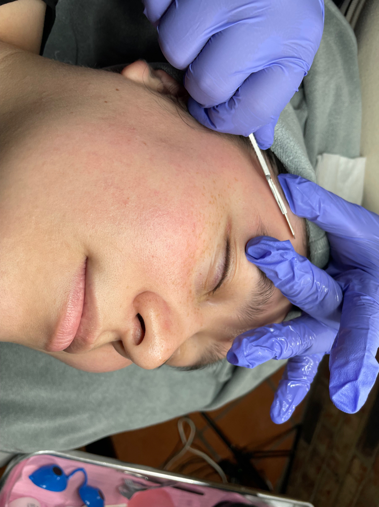 Dermaplaning Facial