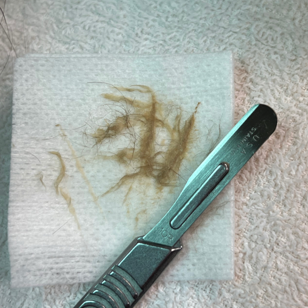 3 Month Basic Dermaplane Package at The Este Lounge in Hanford, CA