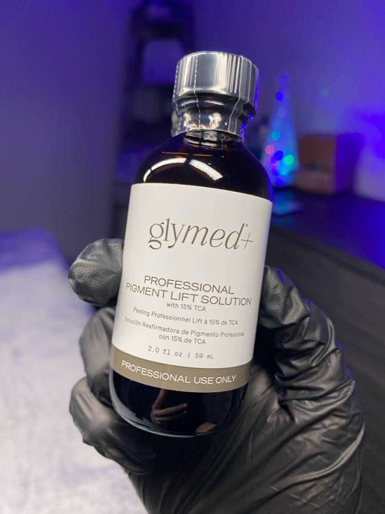 CUSTOM CHEMICAL PEEL