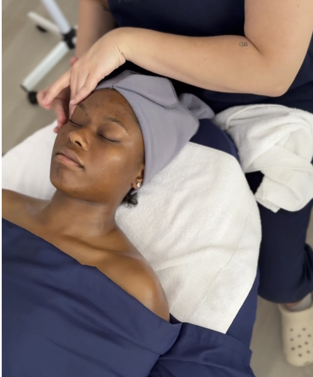 Chemical Peel
