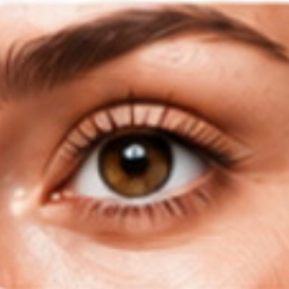 Fusion Plasma Eye Lift at Plasmalift Skin Clinic LLC in Bettendorf, IA